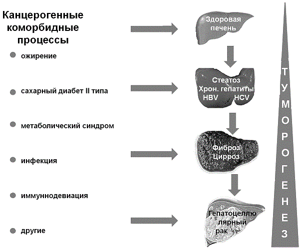 Рис. 2. Коморбидные процессы и гепатоканцерогенез