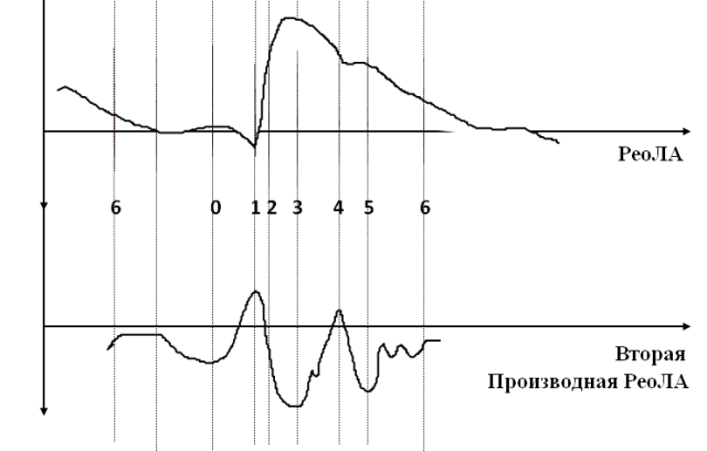 Рис. 1. Фазовая структура цикла легочной артерии.