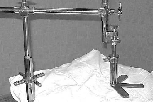 Рис. 1. Веерообразный лапаролифт Рис. 1. Веерообразный лапаролифт