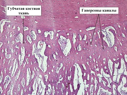 Рис. 3. Препарат костной мозоли перелома бедра кролика, 2 экспериментальная группа, срок 14 дней, окраска гематоксилин-эозином, ув. х10