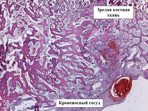 Рис. 7. Препарат костной мозоли перелома бедра кролика, 5 контрольная группа, срок 28 дней, окраска гематоксилин-эозином, ув. х5
