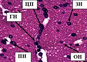 Рис. 13. Полиморфный слои коры больших полушарий при воздействии свинца. Стрелками обозначены: пирамидные нейроны (ПН), зернистые нейроны (ЗН), овальные нейроны (ОН), цепочка перикарионов (ЦП), гиперхромофильные нейроны (ГН). Окраска гематоксилином и эозином. Ув. 40×10.