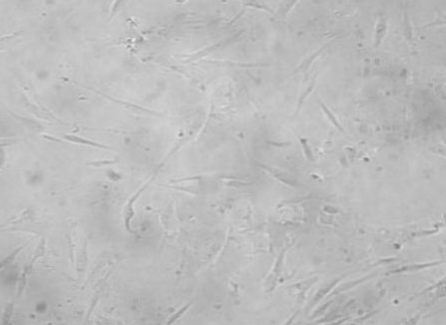 Рис. 1. Нативная культура остеогенных фибробластоподобных клеток человека, 4 пассаж. 1 сутки после пересева. Инвертированный микроскоп, х100.