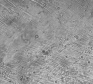 Рис. 11. Нативная культура остеогенных фибробластоподобных клеток нанесенных в суспензии имплантат. Инвертированный микроскоп. 7- е сутки эксперимента, х100.